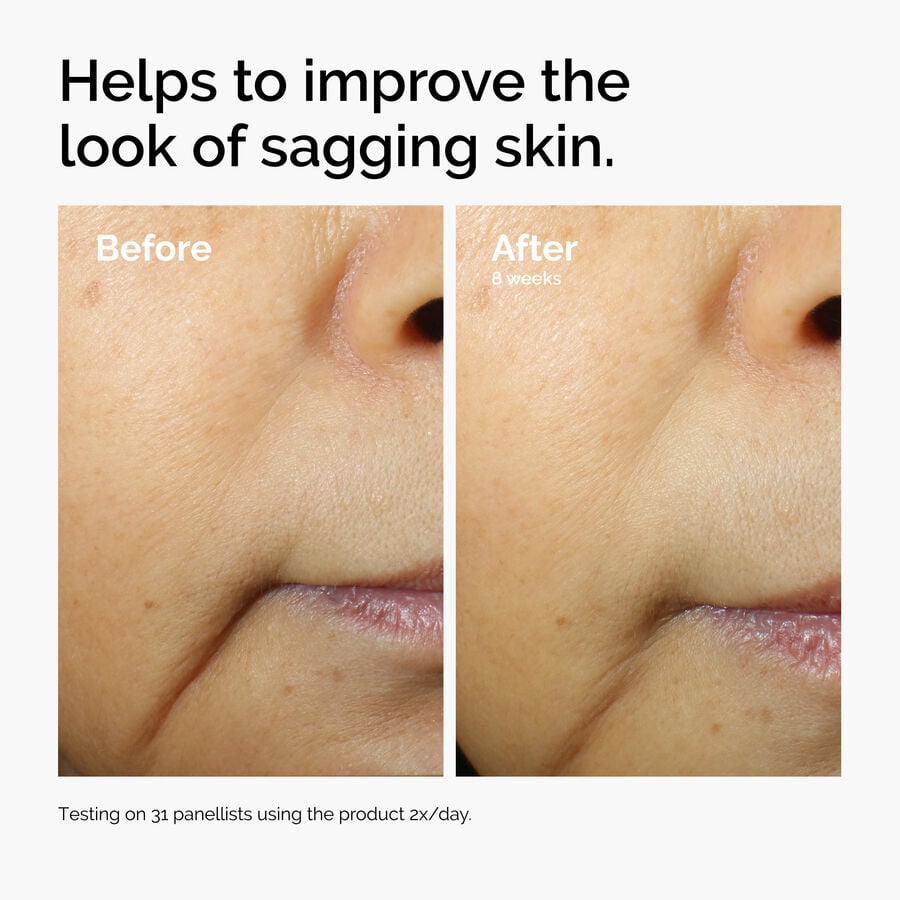 caffeine-3-escin-1-face-serum-a9 ord-caffeine-3pct-escin-1pct-face-serum-before-after-sagging.jpg