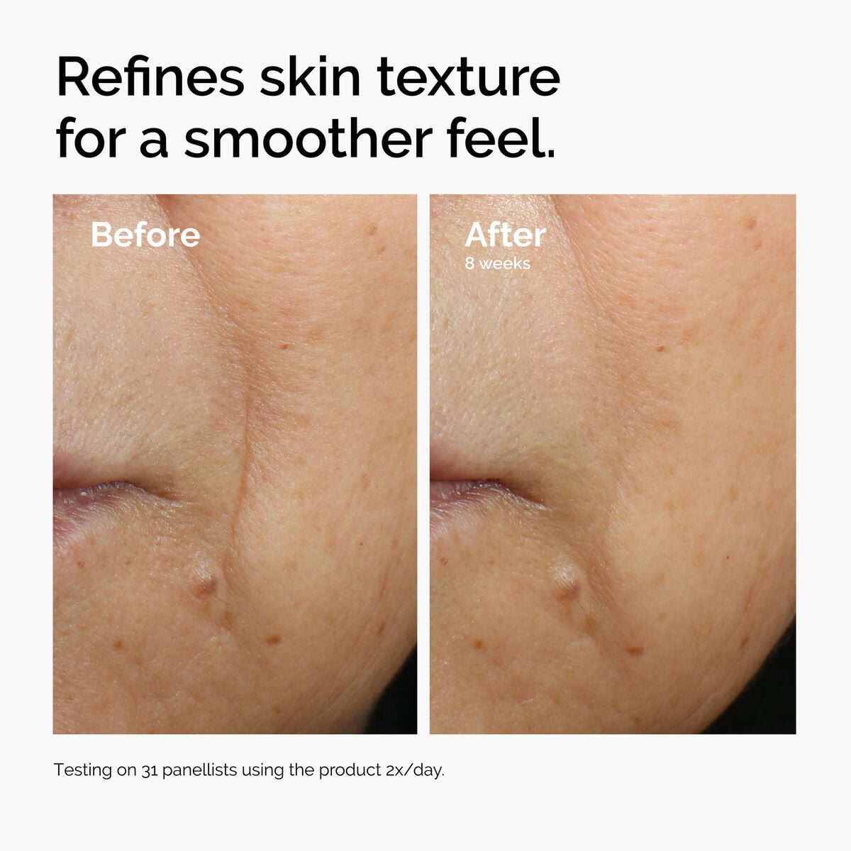 caffeine-3-escin-1-face-serum-a9 ord-caffeine-3pct-escin-1pct-face-serum-before-after-texture.jpg
