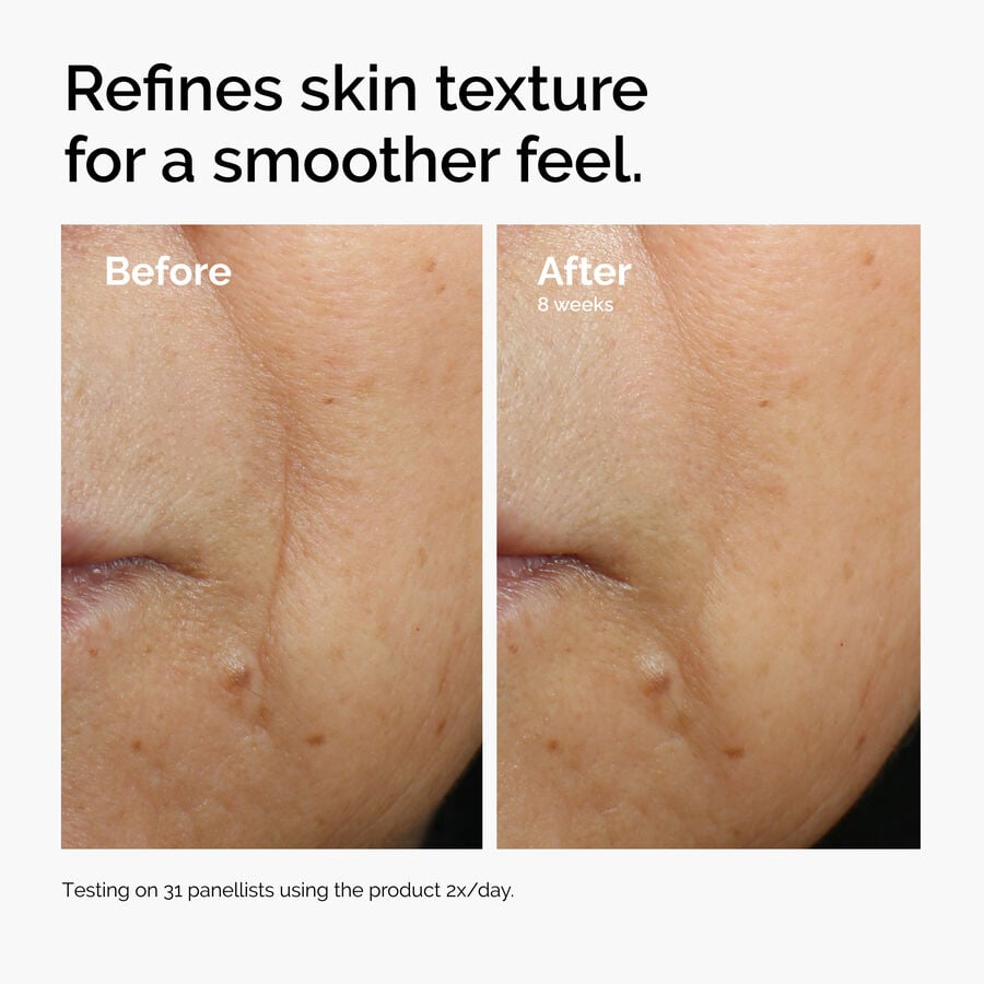 caffeine-3-escin-1-face-serum-a9 ord-caffeine-3pct-escin-1pct-face-serum-before-after-texture.jpg
