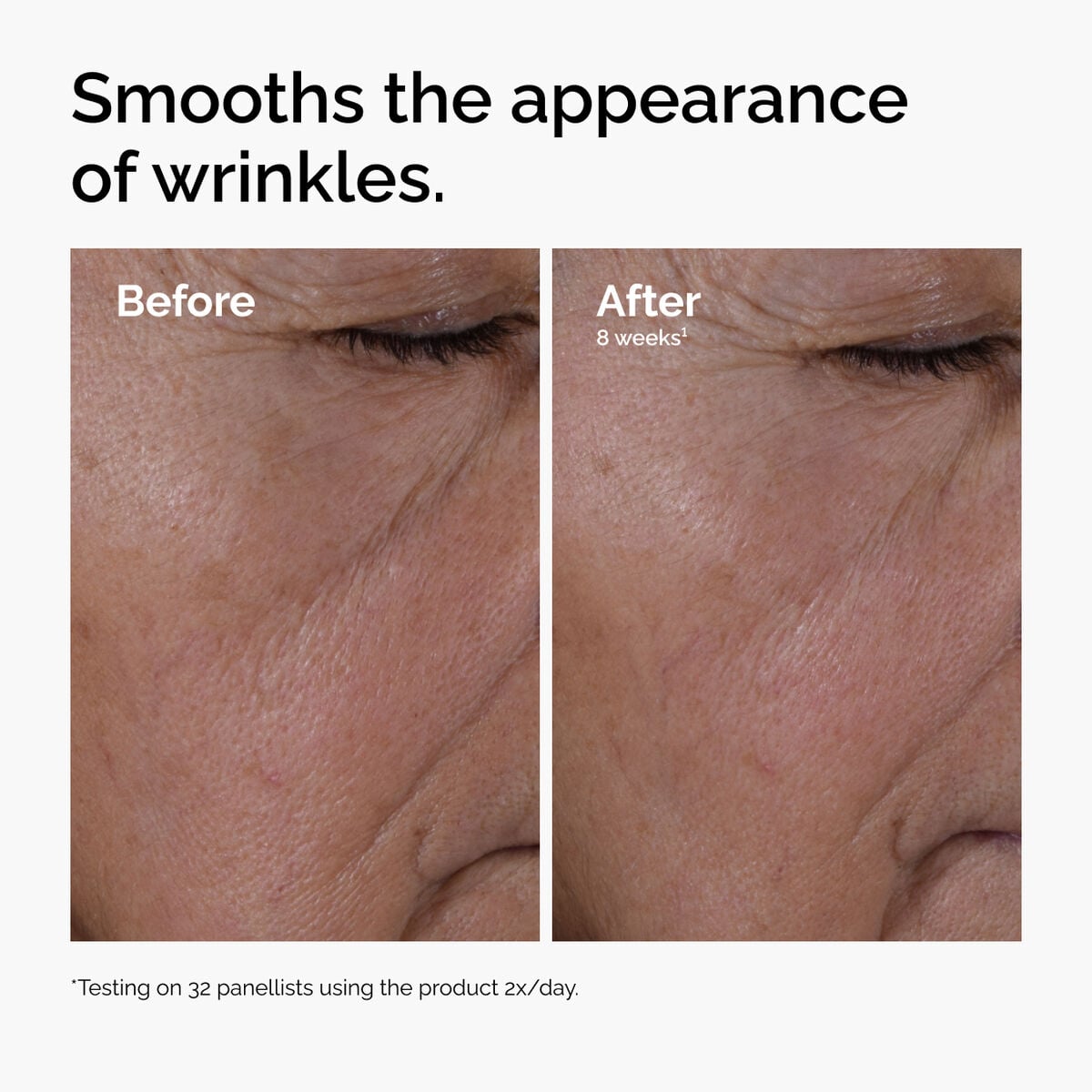 multi-peptide-ha-serum-z9 ord-multi-peptide-ha-serum-wrinkles-before-after.jpg
