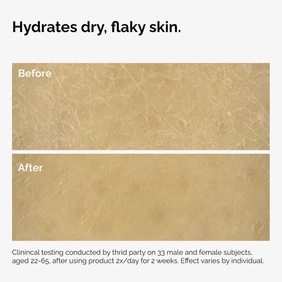 the-body-care-collection-q7 ord-natural-moisturizing-factors-inulin-body-before-after-graphic-02.jpg