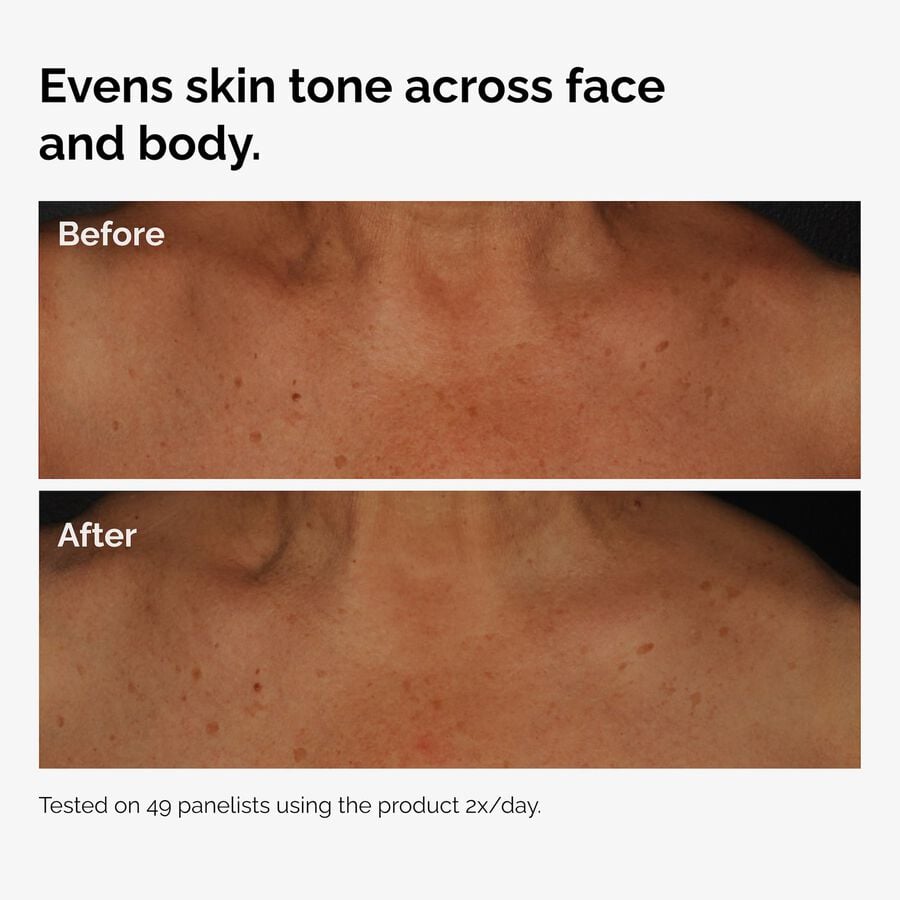 the-body-care-collection-q7 ord-niacinamide-face-body-serum-before-after-even-tone-graphic.jpg