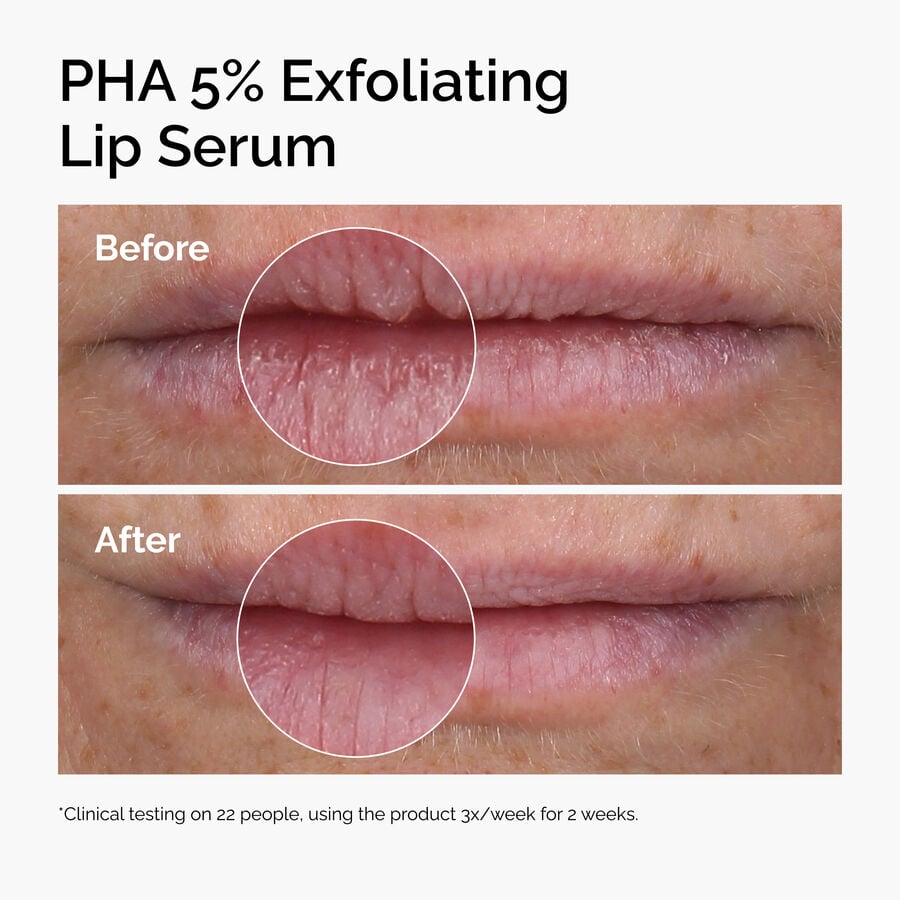 pha-5-exfoliating-lip-serum-e5 ord-pha-5pct-lip-exfoliating-serum-before-after.jpg