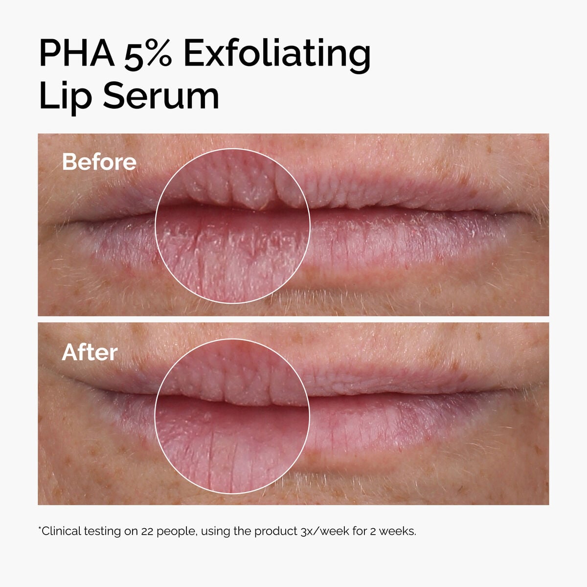 pha-5-exfoliating-lip-serum-e5 ord-pha-5pct-lip-exfoliating-serum-before-after.jpg