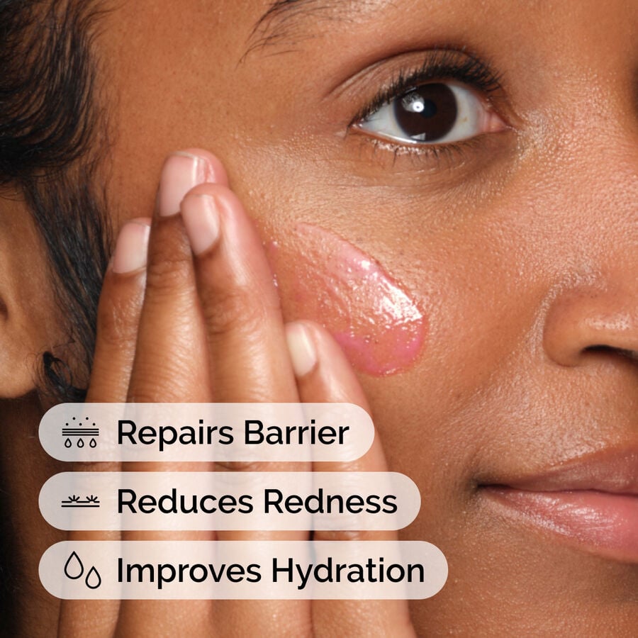 soothing-and-barrier-support-serum-h5 ord-soothing-barrier-support-serum-model-application-with-benefits.jpg
